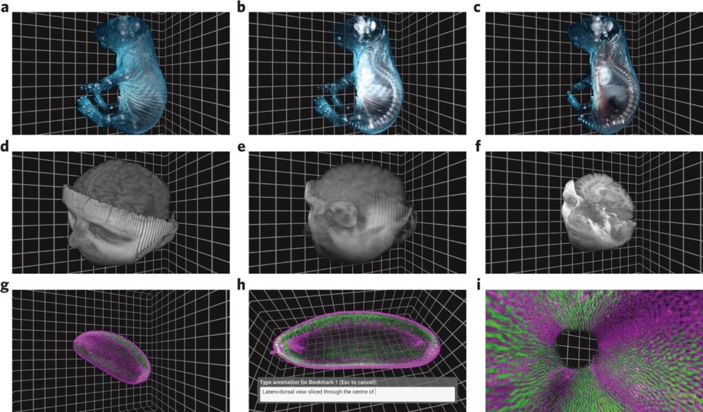 Volumetric data visualization: Medical images